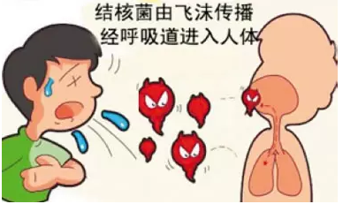 结核病;肺结核;健康;白色瘟疫 结核病;肺结核;健康;白色瘟疫